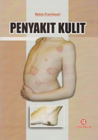 Image of Penyakit Kulit