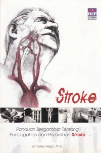 Image of Stroke